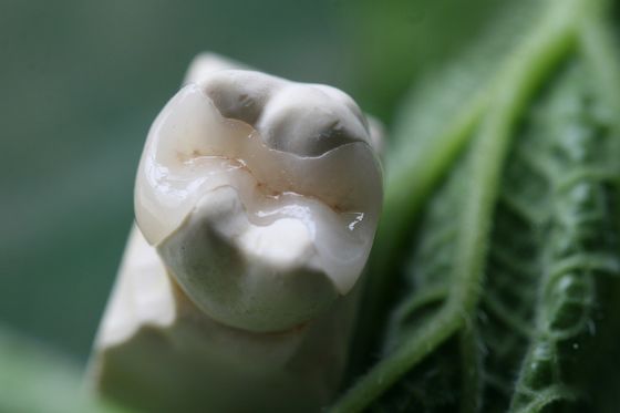 Natural la mirada de toda la porcelana chapea la corona dental de EMAX