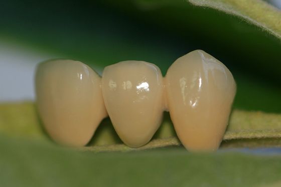 Corona dental del diseño de la circona de cerámica llena dental ISO13485 del laboratorio para los dientes anteriores