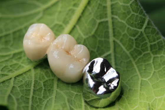 Corona dental del marco PFM del metal
