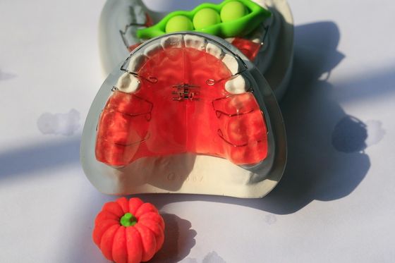 Dispositivo dental ortodóntico de la odontología de encargo del mantenimiento
