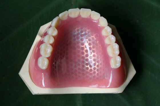 3D que imprime el marco parcial del metal de la dentadura del esqueleto del metal