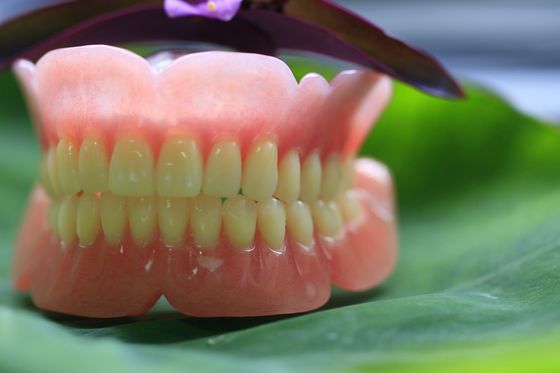 Dentadura parcial de acrílico del arco lleno