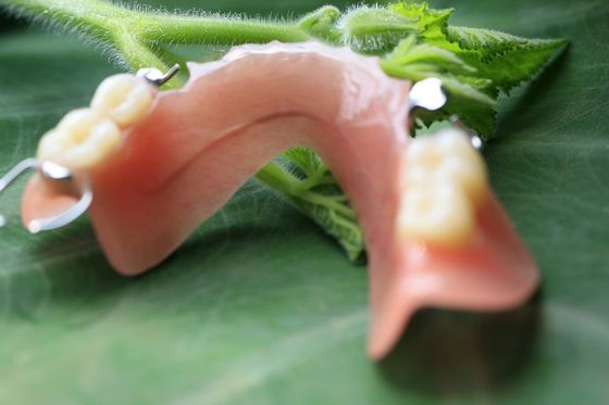 Dentadura parcial de acrílico desprendible parcial