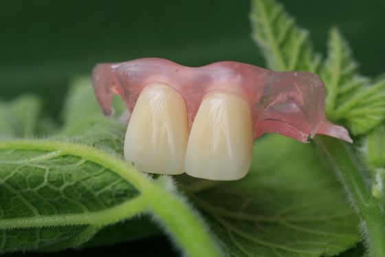 Dentadura invisible flexible