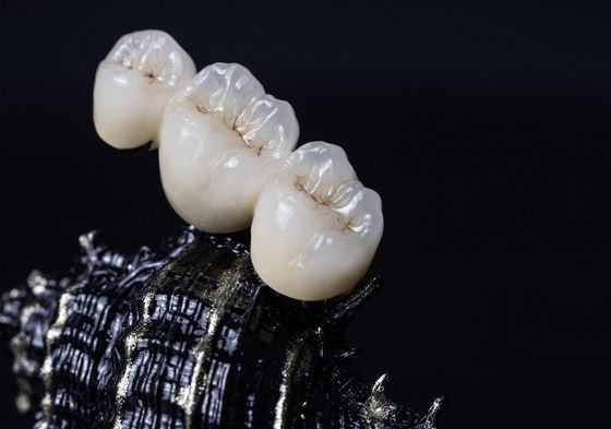 Corona dental del marco PFM del metal