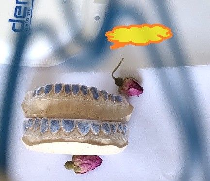 ISO13485 blanqueo de encargo Tray For Whitening Teeth