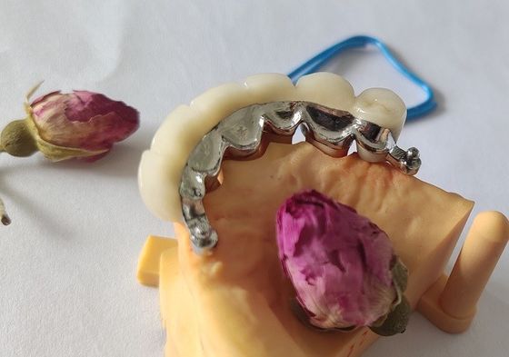 Corona dental del marco PFM del metal