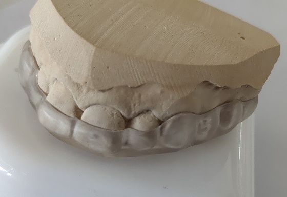 La estética baja el pedazo de boca del arco para el apretón de dientes