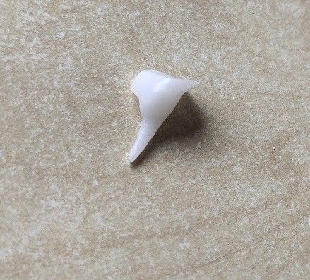 Reforzando la porcelana Pin Core dental de EMAX