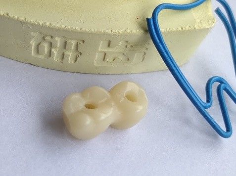 Impresión dental 3D del diseño de la leva del cad