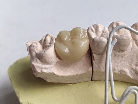 Dientes de la circona cúbica de la porcelana