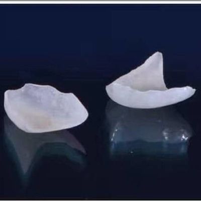 Natural la mirada de toda la porcelana chapea la corona dental de EMAX