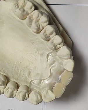 Dentadura invisible suave del cómodo ajuste ISO13485 RPD