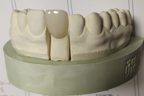 La circona bloquea la impresión dental 3D moliendo de la leva del cad