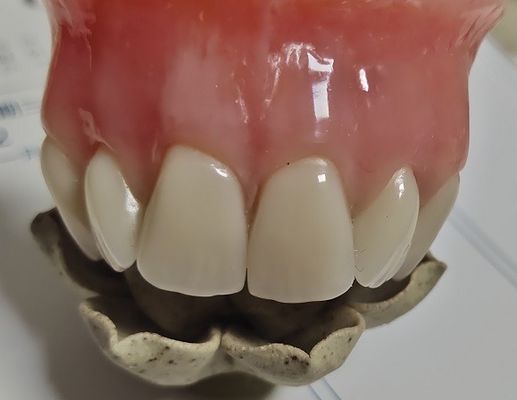 Dentadura parcial de acrílico curada fría de la dentadura llena de la estética