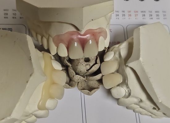 Dentadura invisible suave del cómodo ajuste ISO13485 RPD