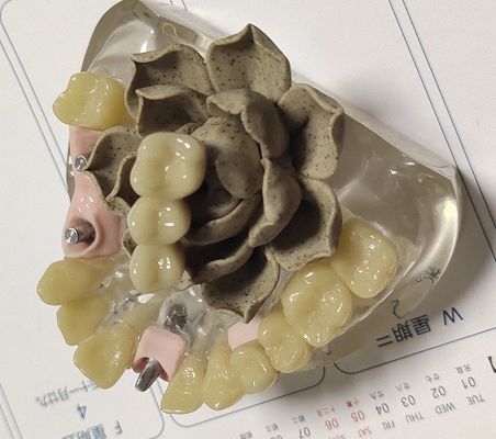 100 corona provisional de Biocompatibility PMMA del por ciento