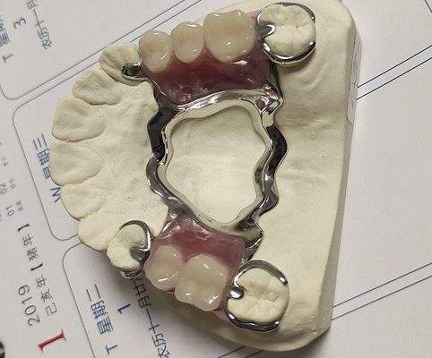 Marco parcial del metal de la dentadura del arco del Co de la aleación maxilar del Cr