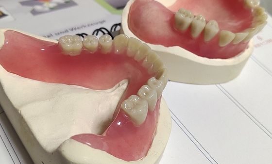 Dentadura de acrílico parcial más baja estética desprendible curada caliente