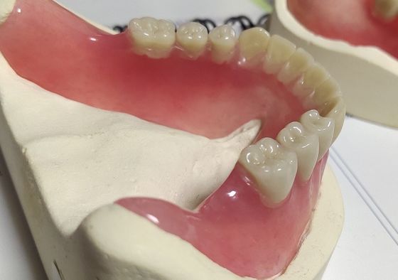 Dentadura parcial de acrílico curada fría de la dentadura llena de la estética