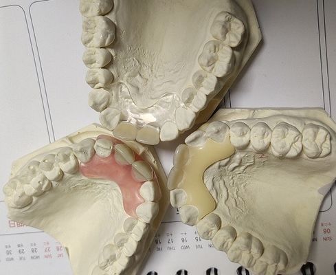 Dentadura invisible suave y elástico temporal de Valplast