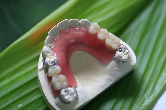 Dentadura invisible flexible parcial para los dientes anteriores
