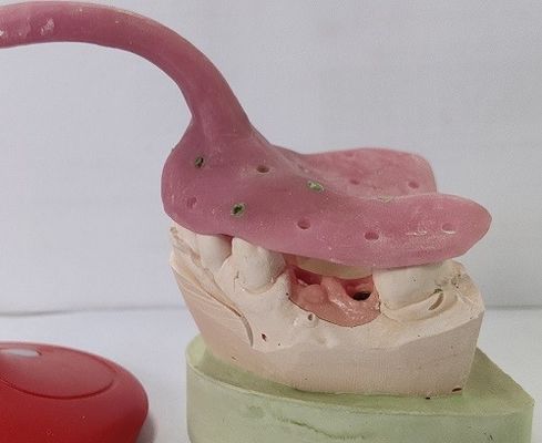 Bandejas de encargo de la impresión de la dentadura