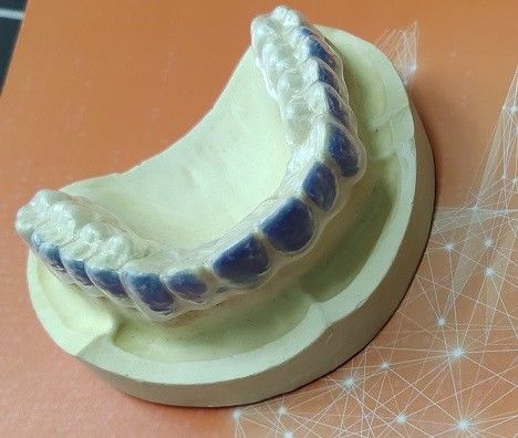 Dientes ISO13485 que blanquean al guardia For Smoke Stains del blanqueo