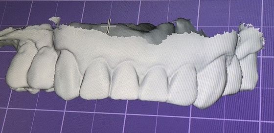 mofa de 3D Digitaces encima de los dientes otros productos dentales