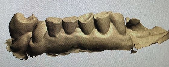 mofa de 3D Digitaces encima de los dientes otros productos dentales