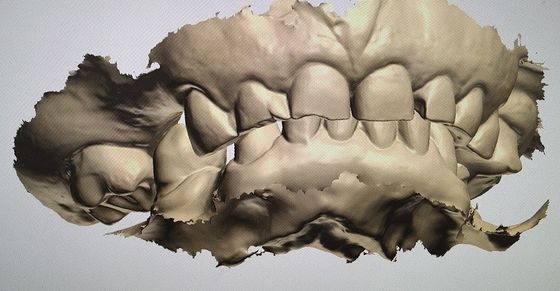 Dientes de la maqueta del indicador digital del diseño de la leva del cad otros productos dentales