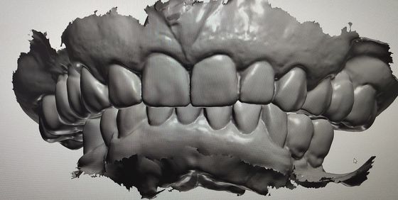 Dientes de la maqueta del indicador digital del diseño de la leva del cad otros productos dentales