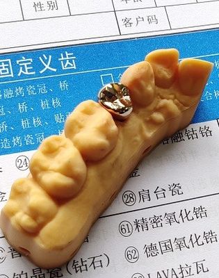 Alta corona dental preciosa de la aleación de oro de la buena aptitud