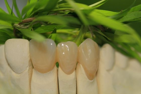 Las estrellas llenas de la corona 5 del óxido de circonio de la odontología prostética diseñan el laboratorio dental