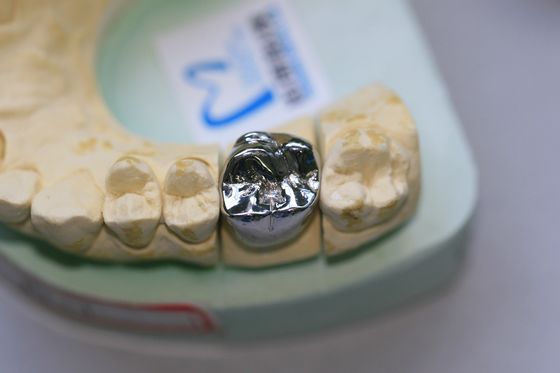 El metal bajo del molde lleno alea la corona dental