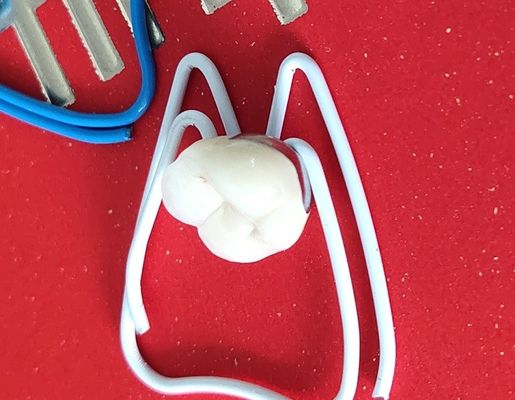 Corona dental de la corona 3D del laboratorio PFM del puente dental de la impresión