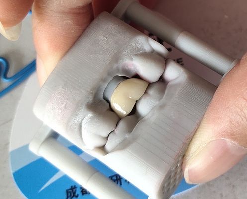 Corona dental de la corona 3D del laboratorio PFM del puente dental de la impresión