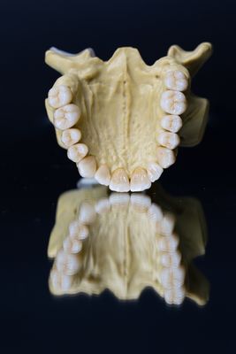 La estética dental de las estrellas de la corona 5 del laboratorio de la circona dental de la porcelana