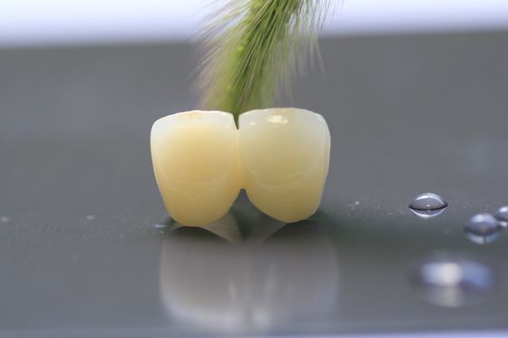 corona dental del laboratorio del marco PFM de la impresión 3D para la odontología