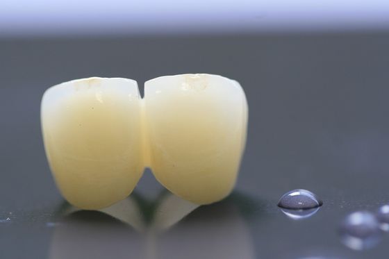 corona dental del laboratorio del marco PFM de la impresión 3D para la odontología
