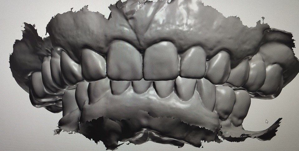 Dientes de la maqueta del indicador digital del diseño de la leva del cad otros productos dentales
