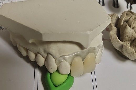 Dentadura invisible suave y elástico temporal de Valplast